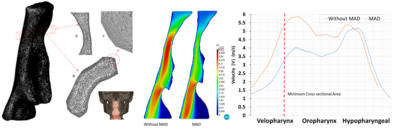 METACOUSTIC: Development of new acoustic meta-materials (panels-liner)s for customized acoustic insulation